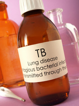 tuberculosis-thumb-160x213-26519.jpg