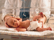 premature infant-thumb-175x131-30472.jpg